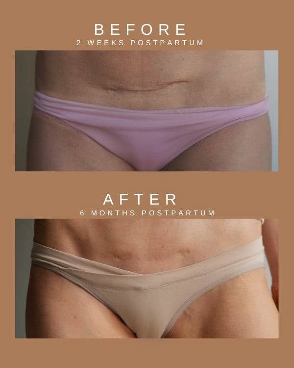 Restorative Scar Cream – Soothing, Science-Backed Care
