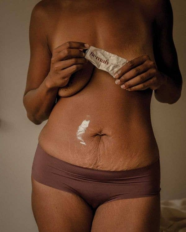 Revitalizing Stretch Mark Cream – Hydrating Body Care